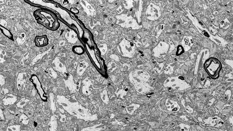 Illustration for article titled Brain Preservation Breakthrough Could Usher in a New Era in Cryonics